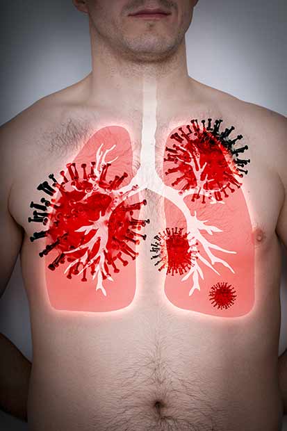 Le Cadmium et le cancer du poumon