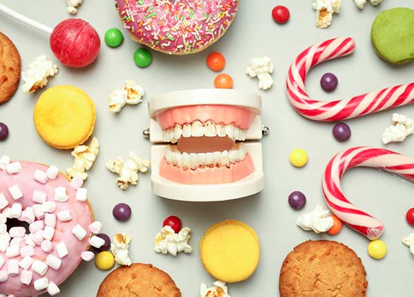 Sucre, alimentation et usure des dents