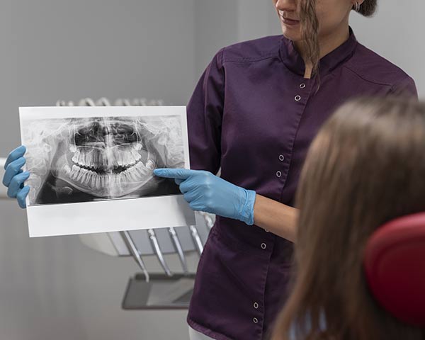 Dents de sagesse et autres questions fréquentes